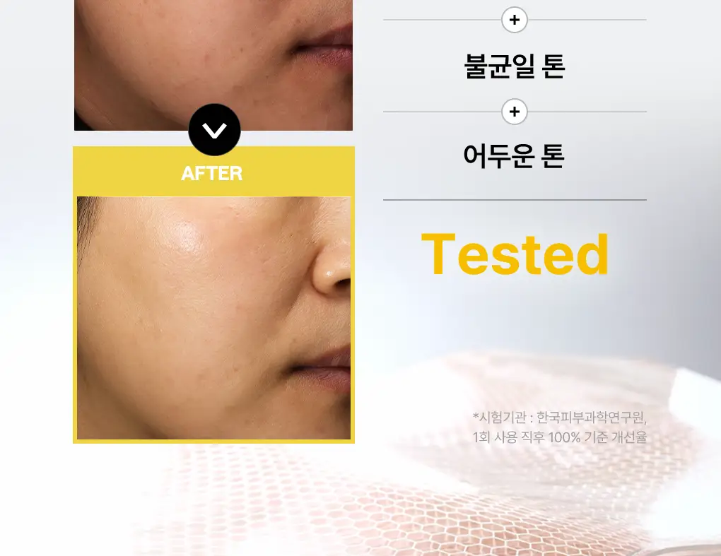 [76관왕 No.1] 메디힐 더마 패드 100매 7종 피부 고민별 골라담기 상세페이지 43